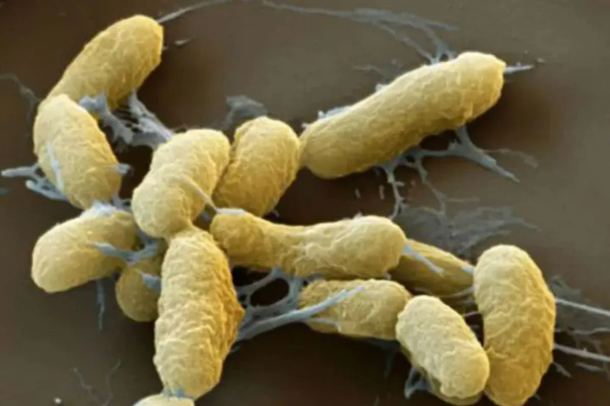 Yersinia pestis: por qué integra la categoría A de agentes de bioterrorismo, según un infectólogo